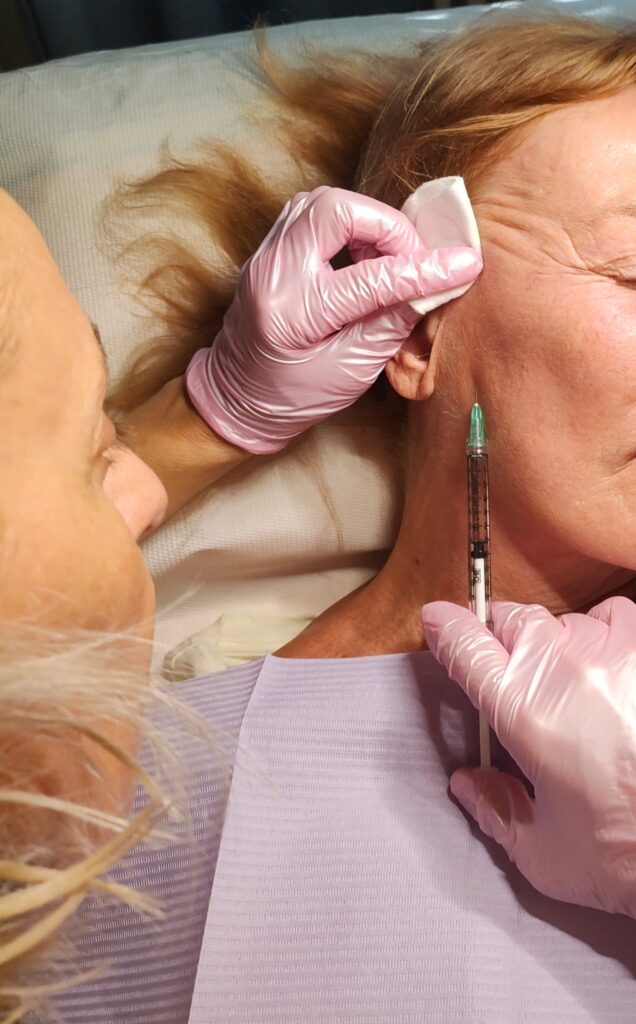 Filler viso Udine